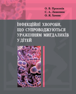 Інфекційні хвороби, що супроводжуються ураженням мигдаликів у дітей